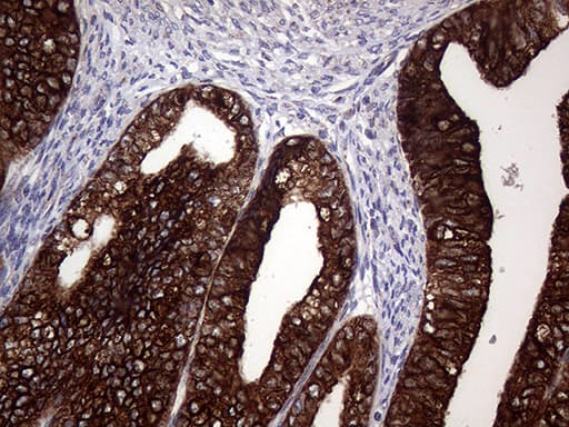 Monoclonal Mouse anti-Human AGR2 Antibody (clone OTI3B5, aa21-175, IHC, WB)