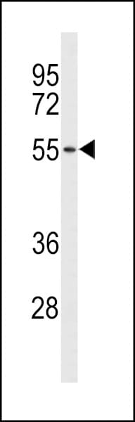 IHC-plus™ ACCN1 / ASIC2 Antibody (aa120-148)