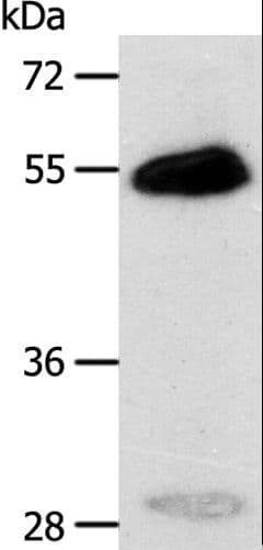 CA14 / Carbonic Anhydrase XIV Antibody
