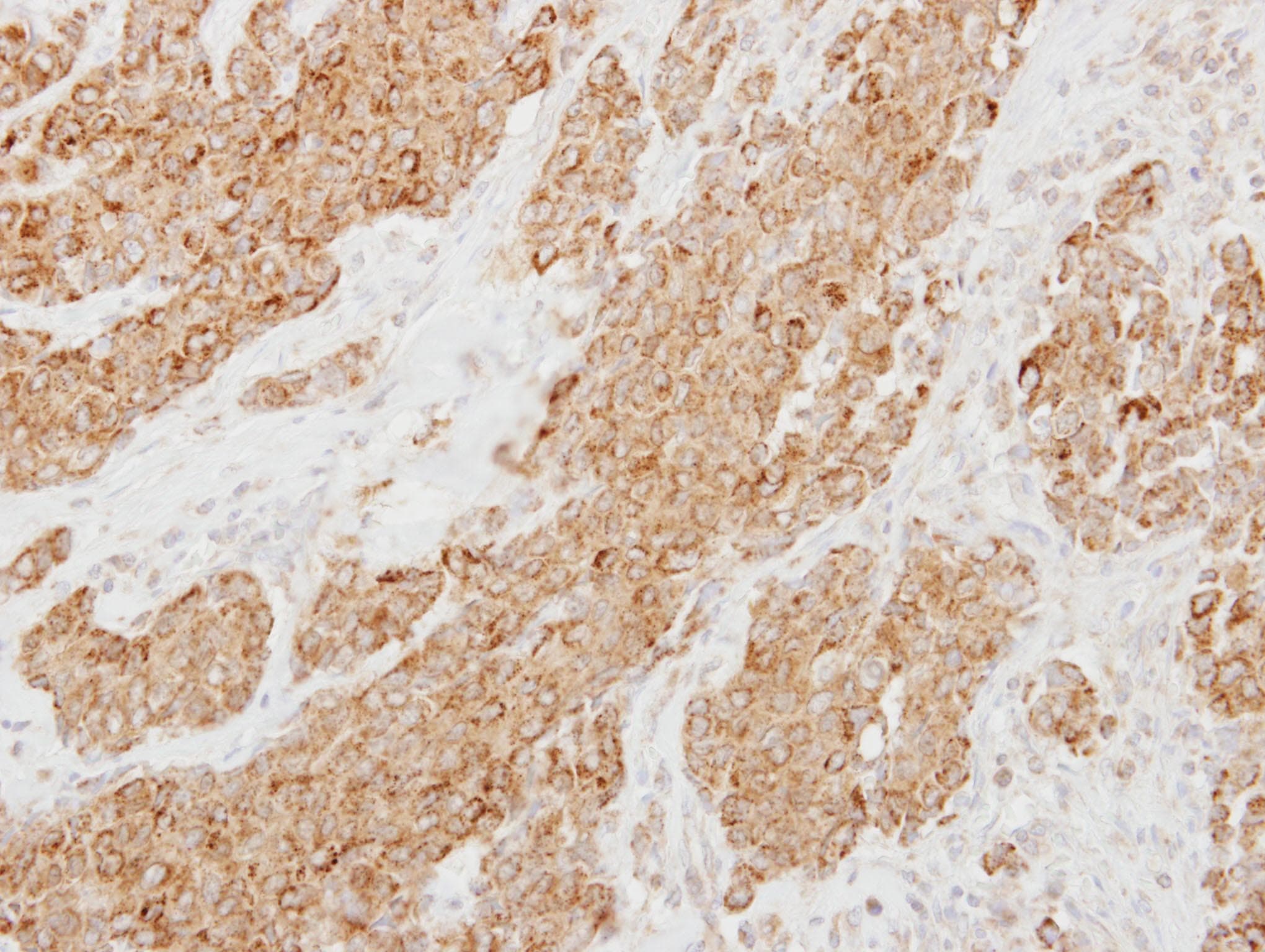 PI15 Antibody (aa195-258)