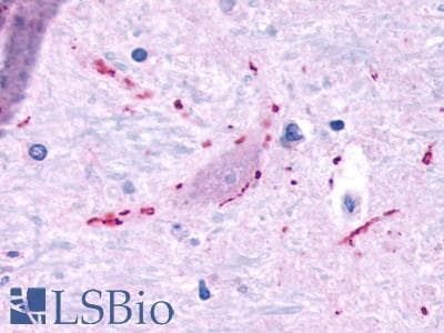 PathPlus™ MRGPRF Antibody (C-Terminus)