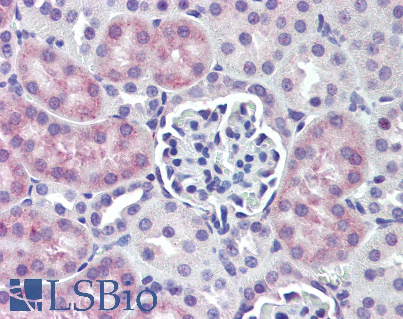 IHC-plus™ Polyclonal Rabbit anti-Mouse ANGPT1 / Angiopoietin-1 Antibody (aa15-45, IHC, WB)