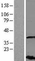 VHLL Protein (Over-Expression Lysate Myc-DDK (Flag))