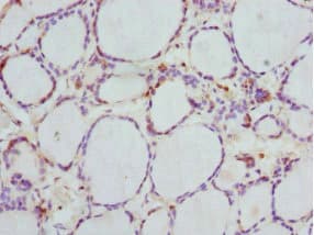 GBE1 Antibody