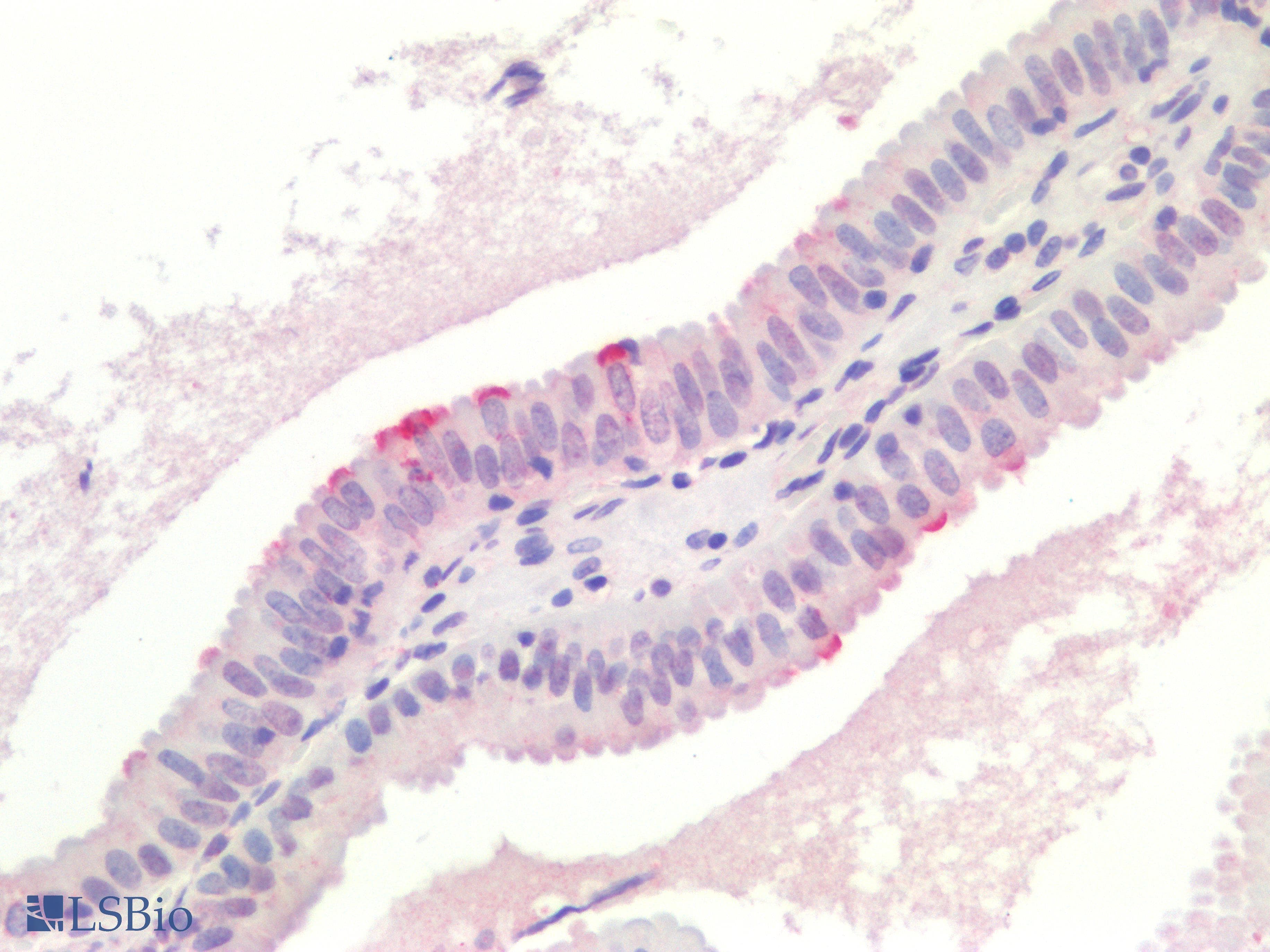 IHC-plus™ GREM1 / Gremlin-1 Antibody