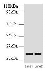 IHC-plus™ Polyclonal Rabbit anti-Human TAGLN / Transgelin / SM22 Antibody (IHC, WB)