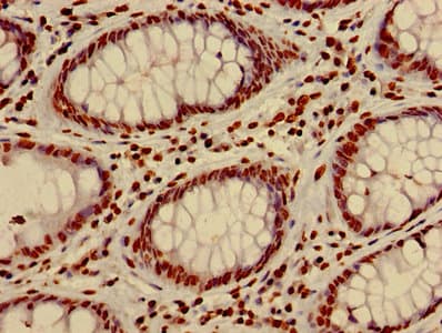 HIST1H4I Antibody