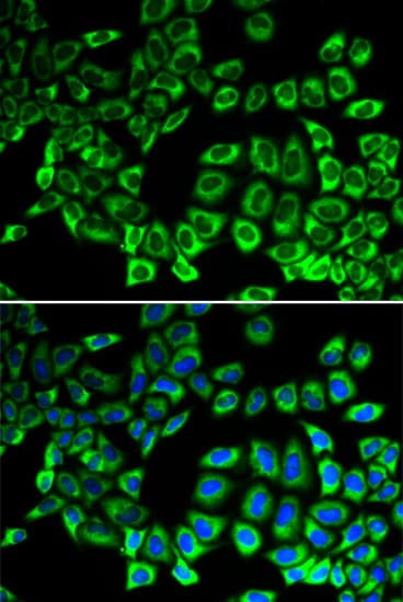 IHC-plus™ Polyclonal Rabbit anti-Human AIMP1 / EMAP II Antibody (IHC, IF, WB)