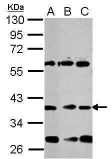NEUROD1 Antibody