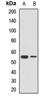 PEPD / PROLIDASE Antibody