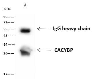 Polyclonal Rabbit anti-Human CACYBP Antibody (IHC, IF, WB)