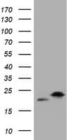NME1 / NM23 Antibody (clone OTI6E8)