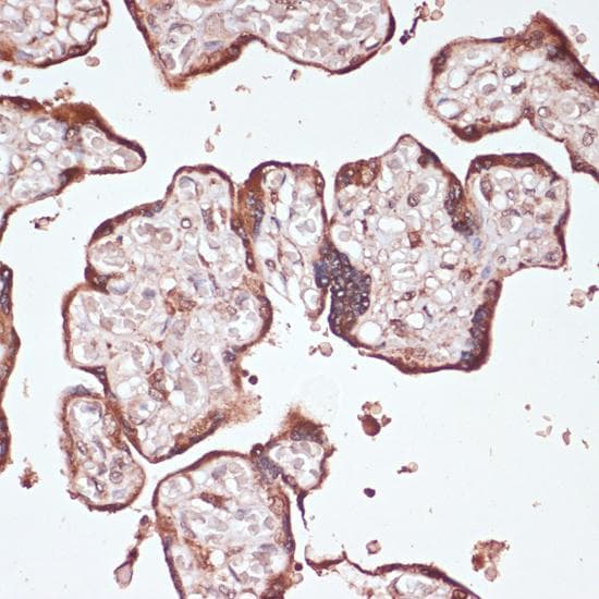 YAP / YAP1 Antibody