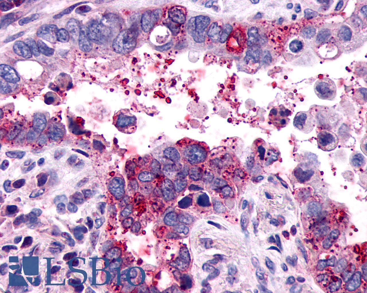 PathPlus™ Polyclonal Rabbit anti-Human F2RL1 / PAR2 Antibody (C-Terminus, IHC)