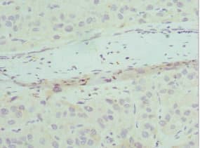 Polyclonal Rabbit anti-Human CHMP2B Antibody (IHC)