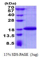 Human SDHAF2 Protein (Recombinant His)