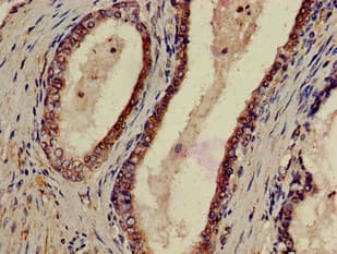 P2RX1 / P2X1 Antibody