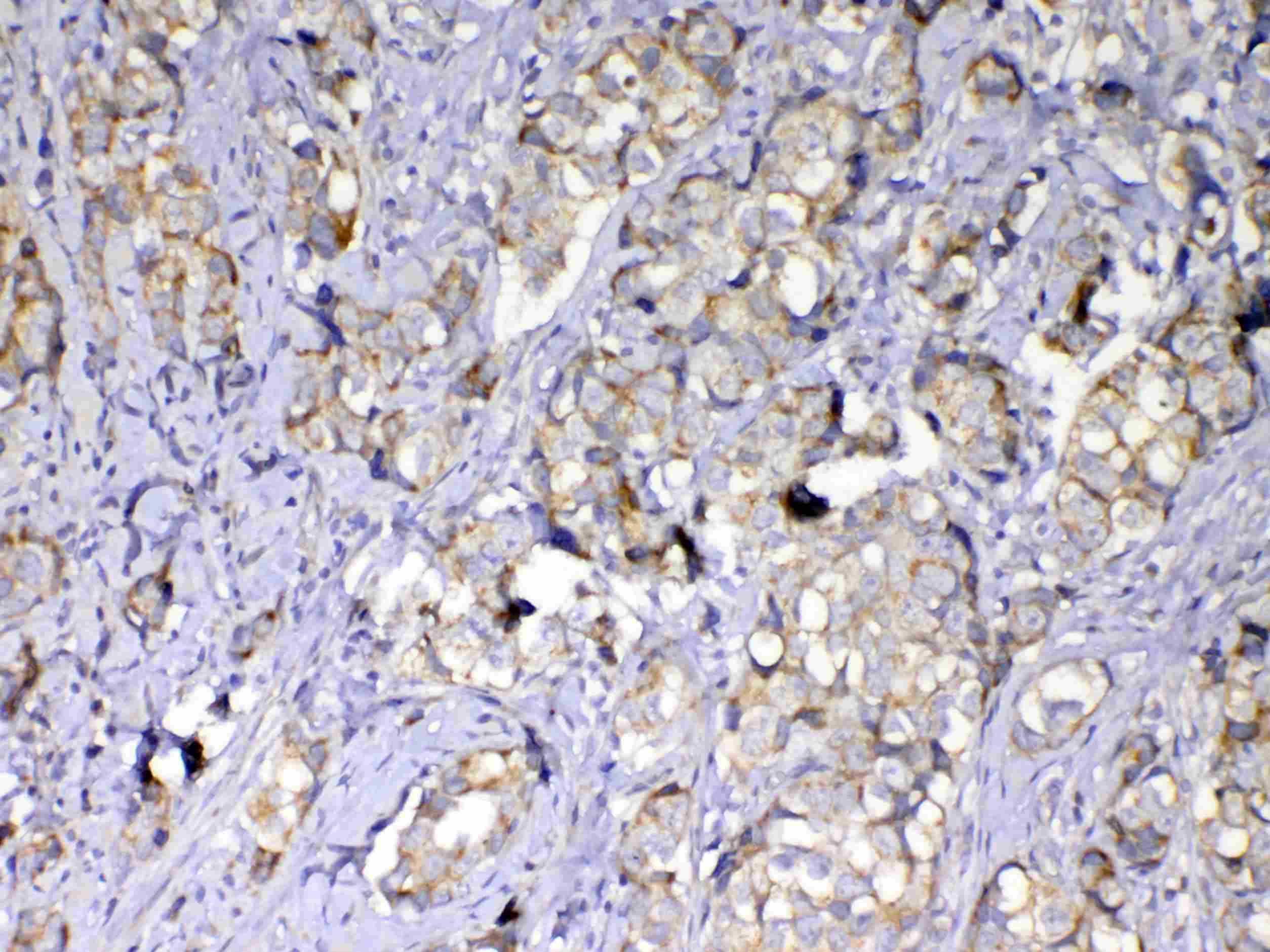 MMP10 Antibody