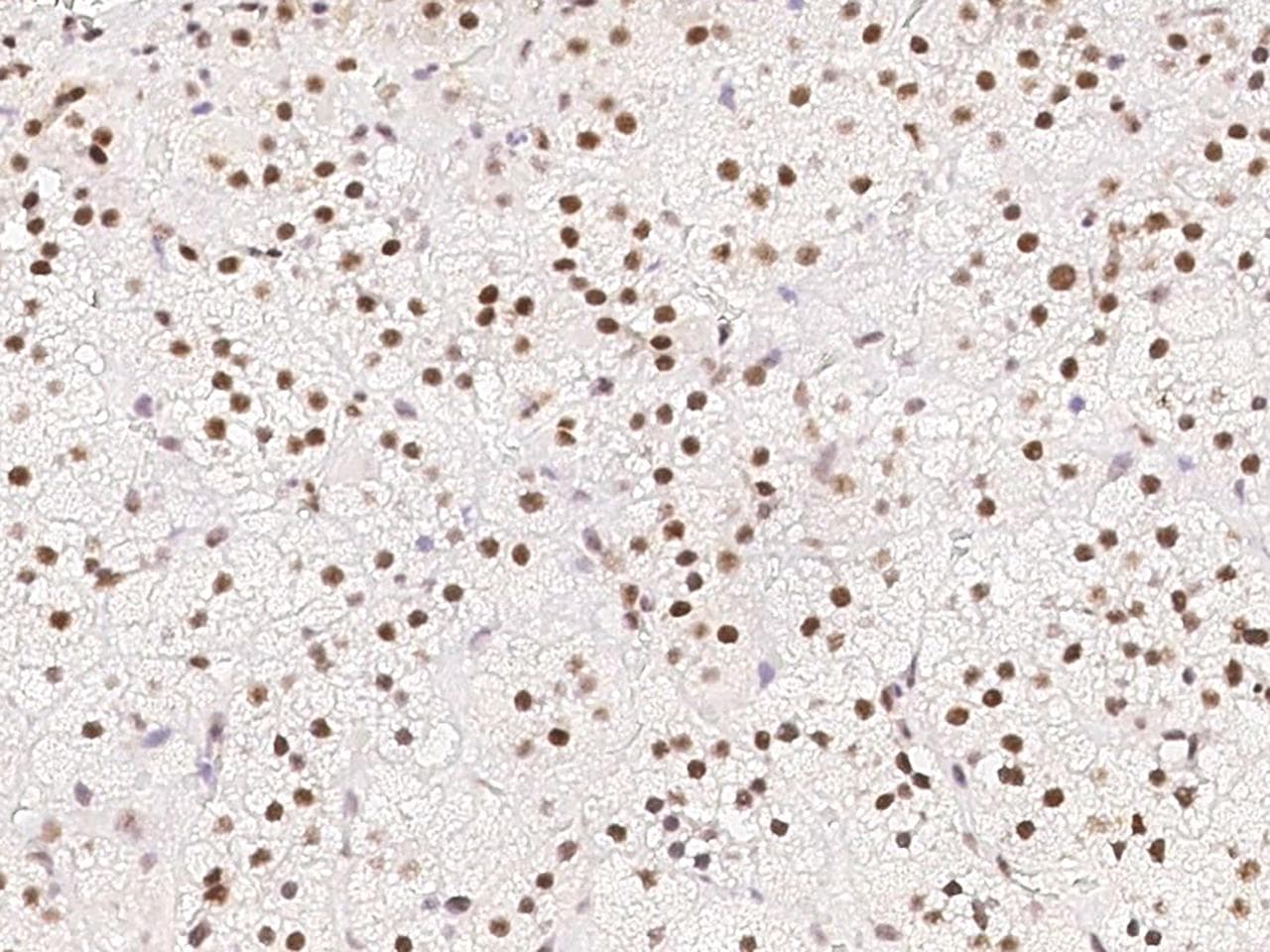 CCNT1 / Cyclin T1 Antibody