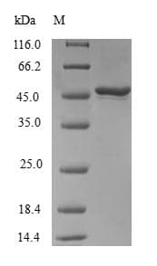 Human RAB31 Protein (Recombinant GST, N-terminus)