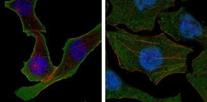Monoclonal Mouse anti-Human CALR / Calreticulin Antibody (clone 1G6A7, aa405-417, IHC, IF, WB)