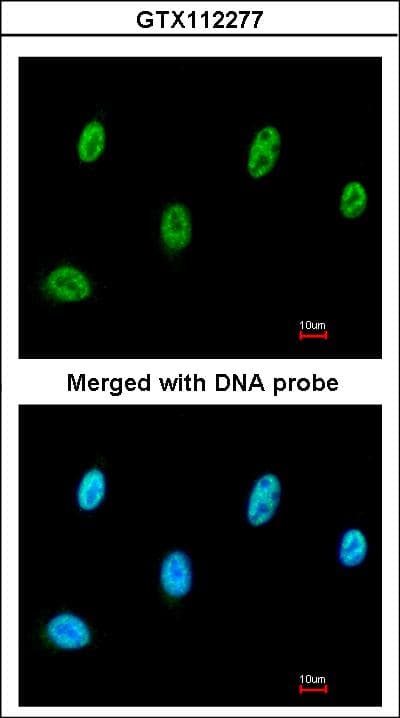 IHC-plus™ Polyclonal Rabbit anti-Human SESN3 Antibody (aa21-296, IHC, WB)