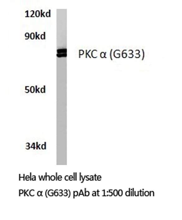 Polyclonal Rabbit anti-Human PRKCA / PKC-Alpha Antibody (Gly633, IHC, WB)