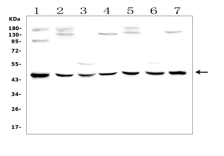 Polyclonal Rabbit anti-Human WWOX Antibody (IHC, WB)