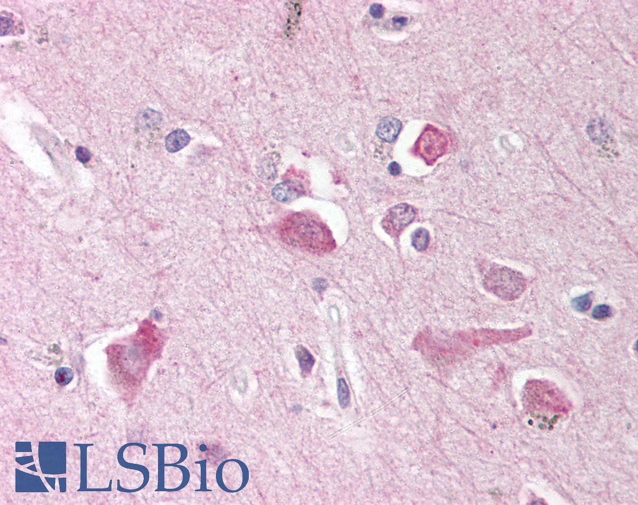 IHC-plus™ NCSTN / Nicastrin Antibody