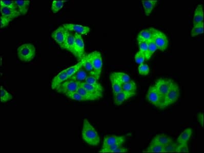 Polyclonal Rabbit anti-Human SEMA4B / Semaphorin 4B Antibody (IHC, WB)