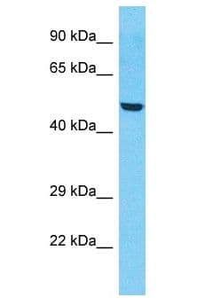 ZNF772 Antibody (aa221-270)