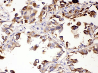 Polyclonal Rabbit anti-Human ALDH7A1 Antibody (IHC, WB)