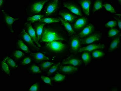 Polyclonal Rabbit anti-Human TIP49 / RUVBL1 Antibody