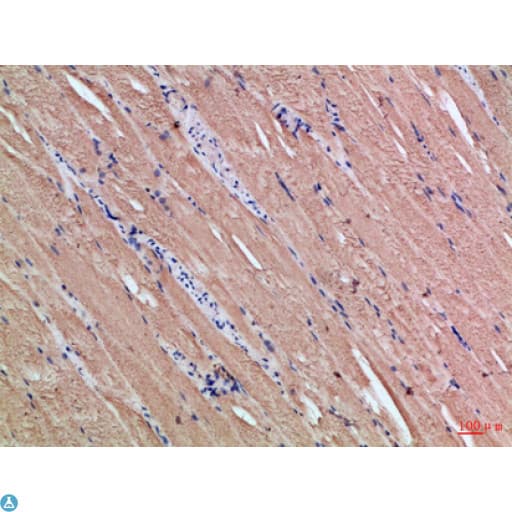 CYGB / Cytoglobin Antibody