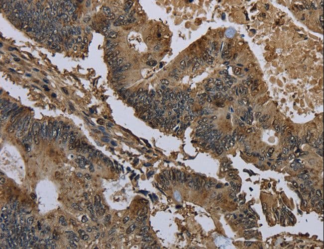 Polyclonal Rabbit anti-Human GSTO1 Antibody (IHC, WB)