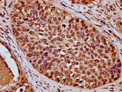 HIST1H4I Antibody