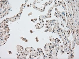 BUB1B / BubR1 Antibody (clone OTI5D9)