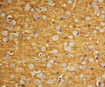 SNAP25 Antibody (aa186-200)