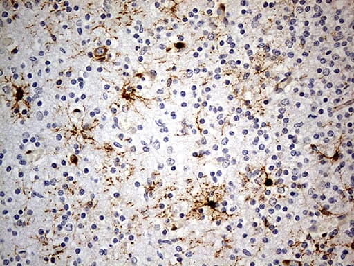 Monoclonal Mouse anti-Human GPR17 Antibody (clone OTI9D6, IHC)