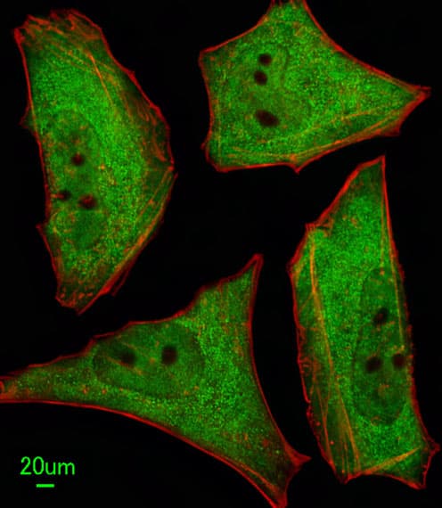 UBQLN1 / Ubiquilin Antibody (aa296-326)