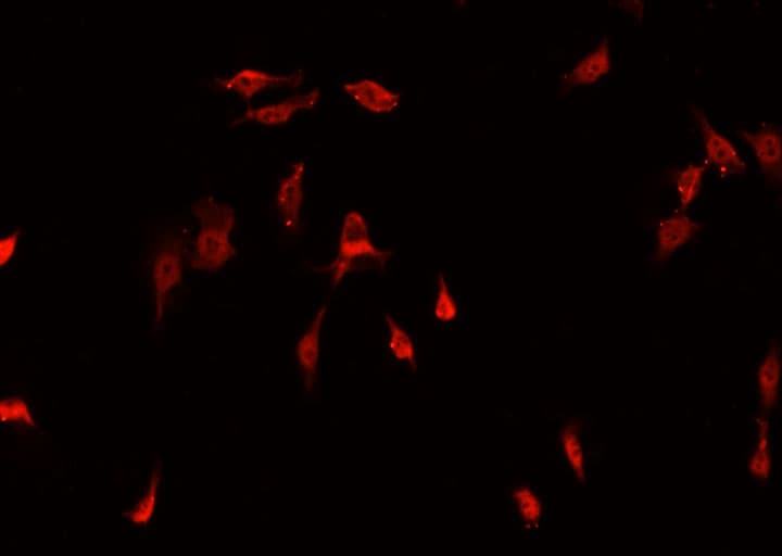 NBN / Nibrin Antibody