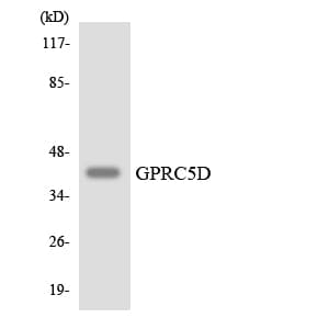 Polyclonal Rabbit anti-Human GPRC5D Antibody (aa257-306, WB)