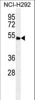 Polyclonal Rabbit anti-Human ABHD8 Antibody (aa410-439, WB)