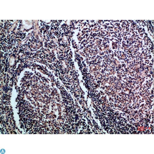 CD1A Antibody