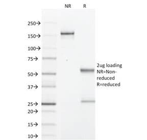 PIP / GCDFP-15 Antibody (clone PIP/1571)