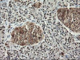 MSI1 / Musashi 1 Antibody (clone OTI1G8, Carrier-free)
