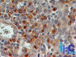 CD69 Antibody (aa103-199, clone 15B5G2, Azide-free)