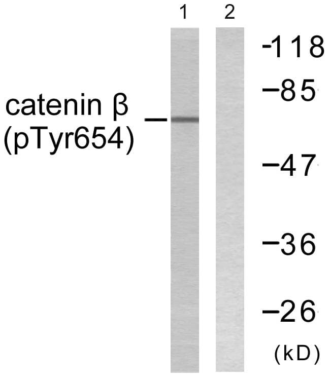 CTNNB1 / Beta Catenin Antibody (phospho-Tyr654)