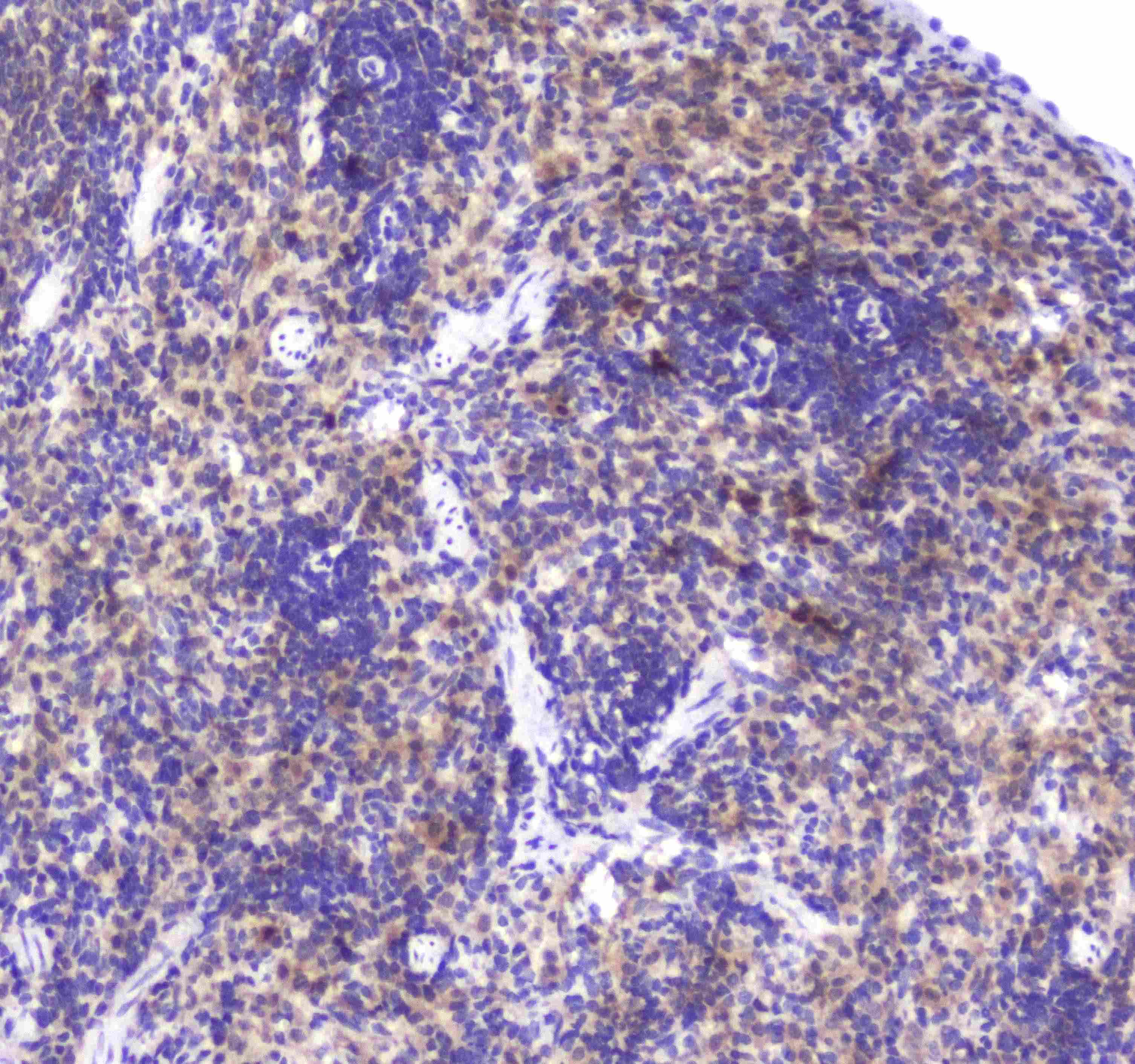 Polyclonal Rabbit anti-Human GLO1 / Glyoxalase I Antibody (IHC, WB)