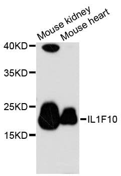 Polyclonal Rabbit anti-Human IL1F10 Antibody (WB)